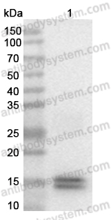 Anti-Monkeypox virus/MPXV L1R Polyclonal Antibody